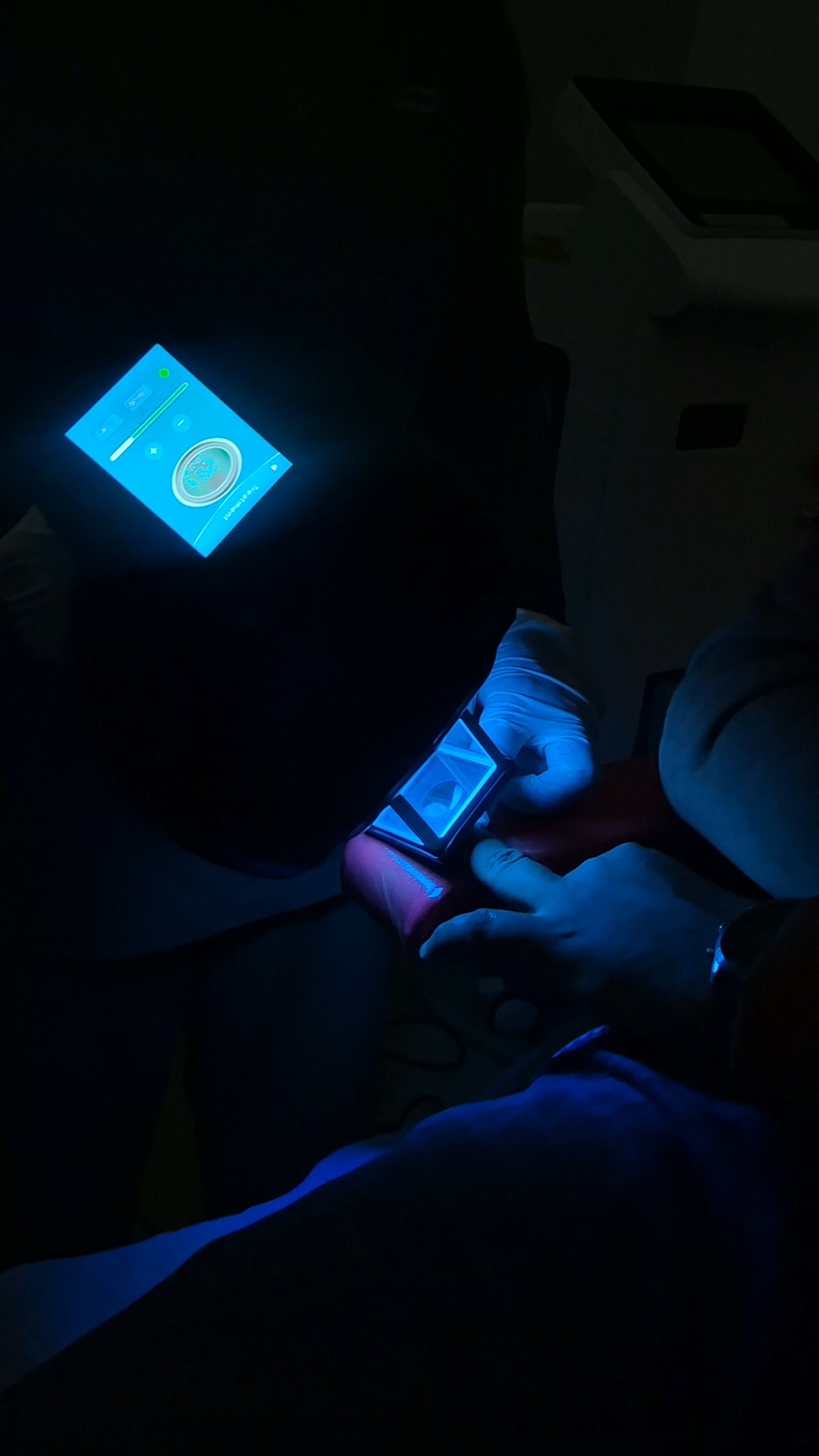Excimer Laser Story